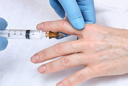 Filler for Hands